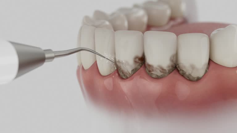 Reliable Dental contractor in Linthicum, MD by Dentist Open Now